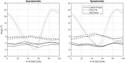 Walking Biomechanics and Spine Loading in Patients With Symptomatic Lumbar Spinal Stenosis